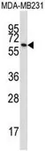 Anti-BTN3A1 antibody used in Western Blot (WB). GTX53488