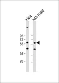 Anti-CRLF3 antibody used in Western Blot (WB). GTX53500