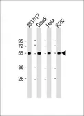 Anti-B7-H6 antibody used in Western Blot (WB). GTX53508