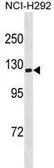 Anti-Sodium/Potassium ATPase alpha 3 antibody used in Western Blot (WB). GTX53511