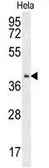 Anti-CMPK2 antibody used in Western Blot (WB). GTX53527