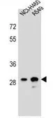 Anti-DHRS4L1 antibody used in Western Blot (WB). GTX53550