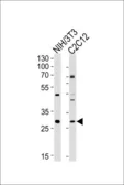 Anti-HOXC9 antibody used in Western Blot (WB). GTX53564