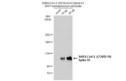 SARS-CoV-2 (COVID-19) Spike S1 overexpression 293T whole cell lysate. GTX535663