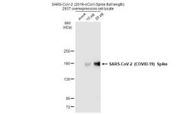 SARS-CoV-2 (COVID-19) Spike overexpression 293T whole cell lysate. GTX535664