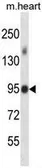 Anti-MLK4 antibody used in Western Blot (WB). GTX53632