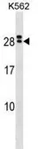 Anti-IL15 Receptor alpha antibody used in Western Blot (WB). GTX53652