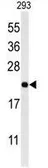 Anti-MRAP antibody used in Western Blot (WB). GTX53669