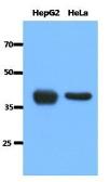 Anti-ACAT1 antibody [AT15E5] used in Western Blot (WB). GTX53681