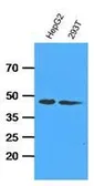 Anti-Adenosine kinase antibody [AT4F8] used in Western Blot (WB). GTX53683
