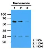 Anti-Calsequestrin 2 antibody [AT4E10] used in Western Blot (WB). GTX53693