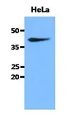 Anti-Creatine kinase MT antibody [AT17A2] used in Western Blot (WB). GTX53700