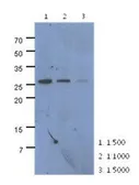 Anti-CMBL antibody [AT2B11] used in Western Blot (WB). GTX53701