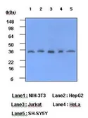 Anti-C Reactive Protein antibody [5A9] used in Western Blot (WB). GTX53706