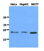 Anti-DNAL1 antibody [AT29E4] used in Western Blot (WB). GTX53709