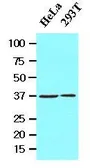 Anti-Laforin antibody [k2A3] used in Western Blot (WB). GTX53711