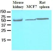 Anti-FLIP antibody [5D8] used in Western Blot (WB). GTX53717