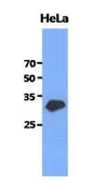 Anti-GCLM antibody [AT2D12] used in Western Blot (WB). GTX53719
