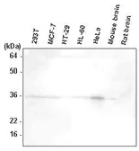 Anti-HTRA2 antibody [1B3] used in Western Blot (WB). GTX53729