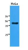 Anti-Cytokeratin 23 antibody [AT2F6] used in Western Blot (WB). GTX53735