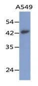 Anti-Layilin antibody [AT20G8] used in Western Blot (WB). GTX53736