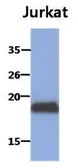Anti-MAFK antibody [AT2F7] used in Western Blot (WB). GTX53738
