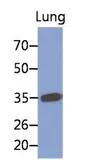 Anti-MFAP4 antibody [AT12D11] used in Western Blot (WB). GTX53740