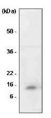 Anti-MIF antibody [4E4] used in Western Blot (WB). GTX53741
