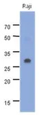 Anti-MyD88 antibody [AT22F11] used in Western Blot (WB). GTX53746