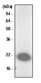 Anti-Park7 / DJ-1 antibody [1B11] used in Western Blot (WB). GTX53757