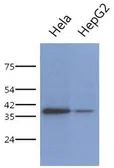 Anti-PCBP1 antibody [AT2A10] used in Western Blot (WB). GTX53759