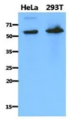 Anti-PDZK1 antibody [AT1A2] used in Western Blot (WB). GTX53760