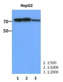 Anti-PFKM antibody [AT2F11] used in Western Blot (WB). GTX53761