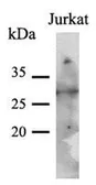 Anti-PNMT antibody [AT1C11] used in Western Blot (WB). GTX53764