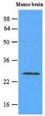 Anti-RAB5A antibody [3A4] used in Western Blot (WB). GTX53775