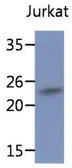 Anti-SSR2 antibody [AT31G6] used in Western Blot (WB). GTX53784