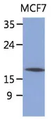 Anti-SSR4 antibody [AT26G5] used in Western Blot (WB). GTX53785