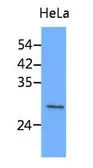 Anti-Stomatin antibody [AT33F5] used in Western Blot (WB). GTX53788