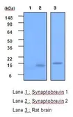 Anti-VAMP2 antibody [3E5] used in Western Blot (WB). GTX53789