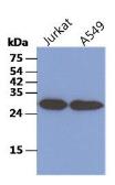 Anti-CKAP1 antibody [AT1F6] used in Western Blot (WB). GTX53790