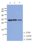 Anti-TNNI1 antibody [AT36E7] used in Western Blot (WB). GTX53792