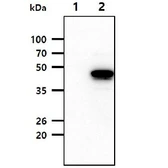 Anti-SERPINA12 antibody [1C4] used in Western Blot (WB). GTX53798