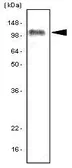 Anti-TLR7 antibody [4F4] used in Western Blot (WB). GTX53802