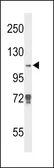Anti-KDM4B antibody used in Western Blot (WB). GTX53804
