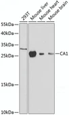 Anti-Carbonic Anhydrase 1 antibody used in Western Blot (WB). GTX53905