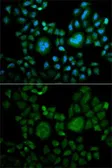 Anti-Carbonic Anhydrase II antibody used in Immunocytochemistry/ Immunofluorescence (ICC/IF). GTX53908