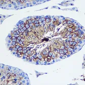 Anti-CD47 antibody used in IHC (Paraffin sections) (IHC-P). GTX53912