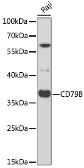Anti-CD79b antibody used in Western Blot (WB). GTX53917