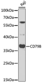 Anti-CD79b antibody used in Western Blot (WB). GTX53917