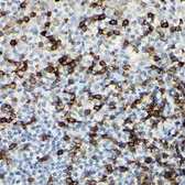 Anti-CD3 zeta antibody used in IHC (Paraffin sections) (IHC-P). GTX53919